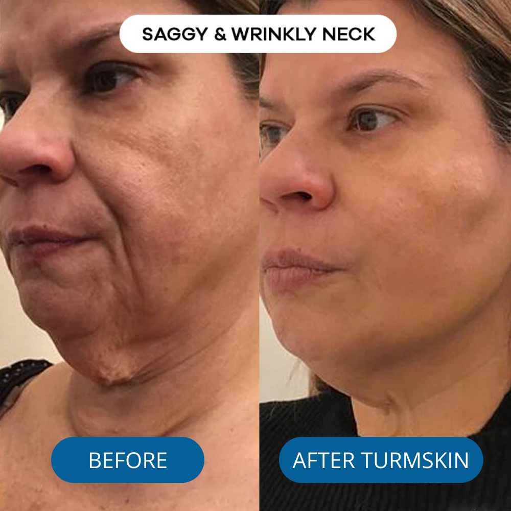 3% Hyaluronic Acid Ultra Hydrating Serum by TurmSkin