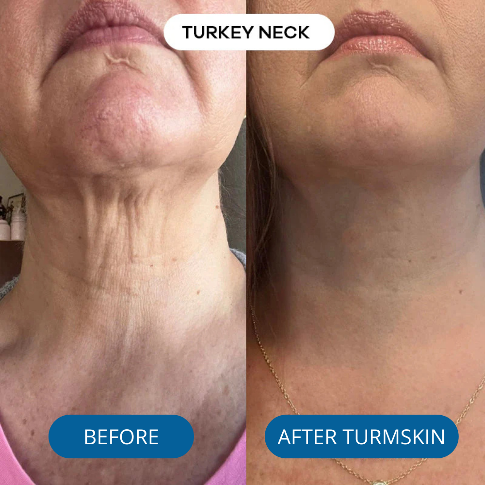 3% Hyaluronic Acid Ultra Hydrating Serum by TurmSkin