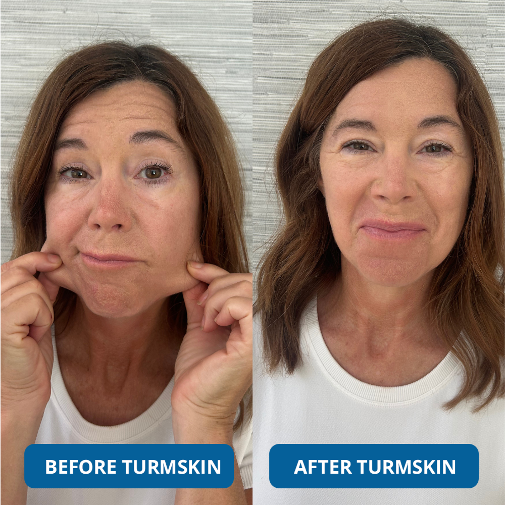 GLASS SKIN Ultra Hydrating Serum by TurmSkin