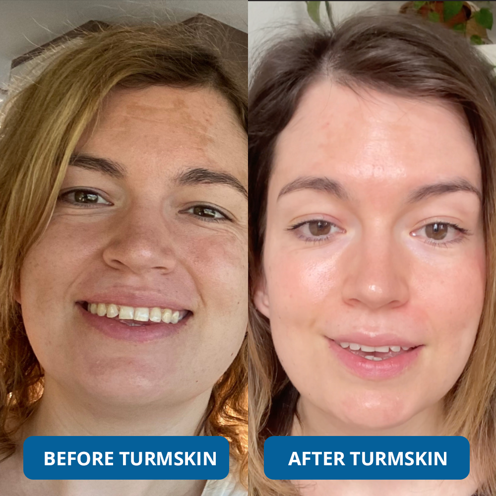 GLASS SKIN Ultra Hydrating Serum by TurmSkin