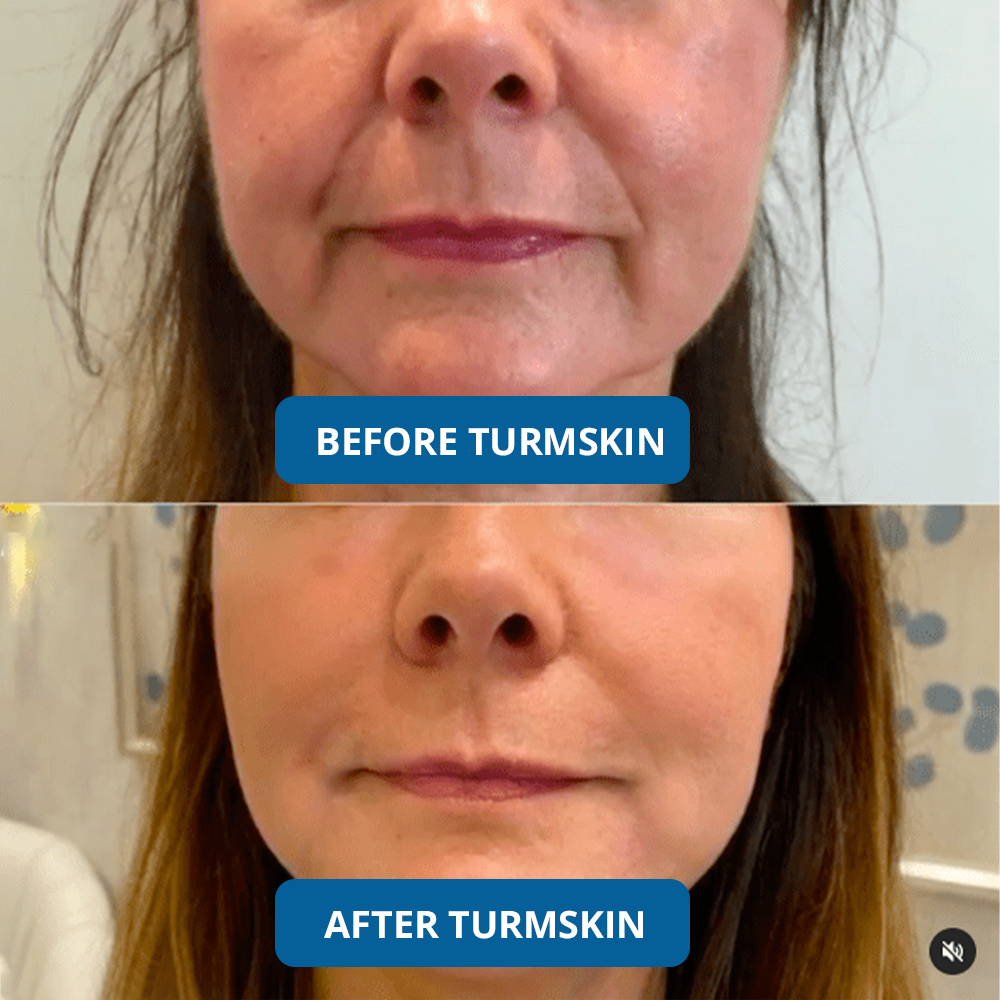 GLASS SKIN Ultra Hydrating Serum by TurmSkin