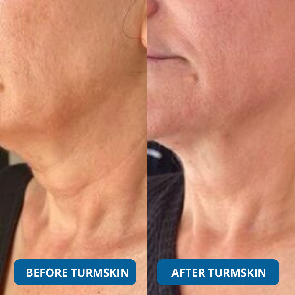 GLASS SKIN Ultra Hydrating Serum by TurmSkin