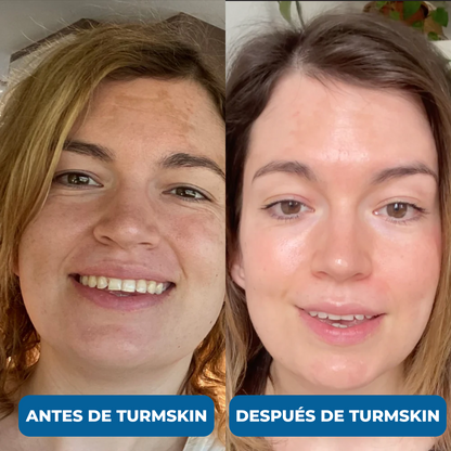 Suero Ultra Hidratante con Ácido Hialuronico 3% de TurmSkin